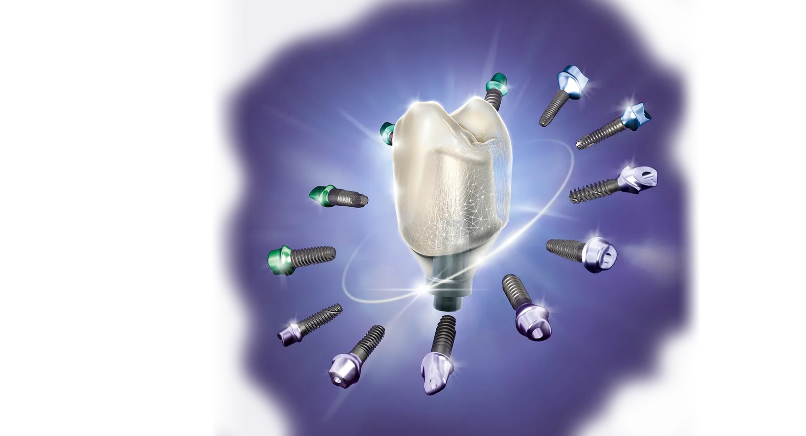 exocad DentalCAD License