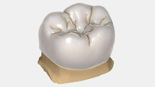 exocad DentalCAD License