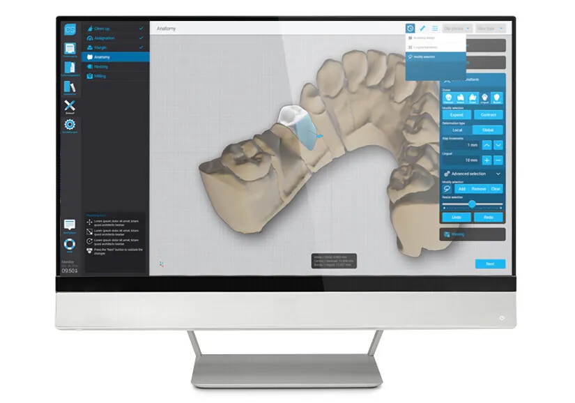 Dental Wings DWOS License
